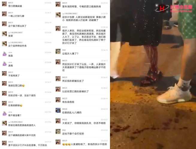 【司机拉客捅人事件】青岛 营口路 临沂人因口角捅人事件