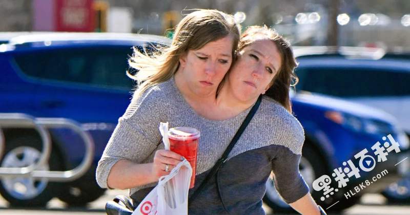 Conjoined-Twins-Abby-and-Brittany-Hensel-Spotted-Shopping-at-Target-After-Abbys-Wedding-Reveal-003.jpg